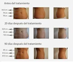 Máquina Profesional de Presoterapia para Cuerpo